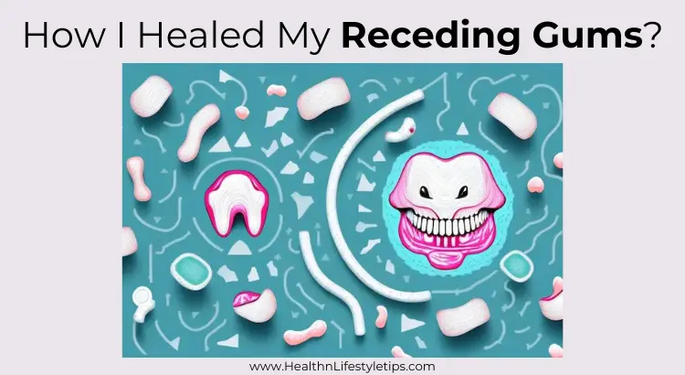 how-i-healed-my-receding-gums-naturally