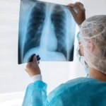How Much Are X-Rays without Insurance